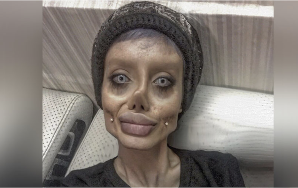 ‘Corpse Bride’: Internet slams woman who had ’50 surgeries’ to look like Angelina Jolie… or did she?