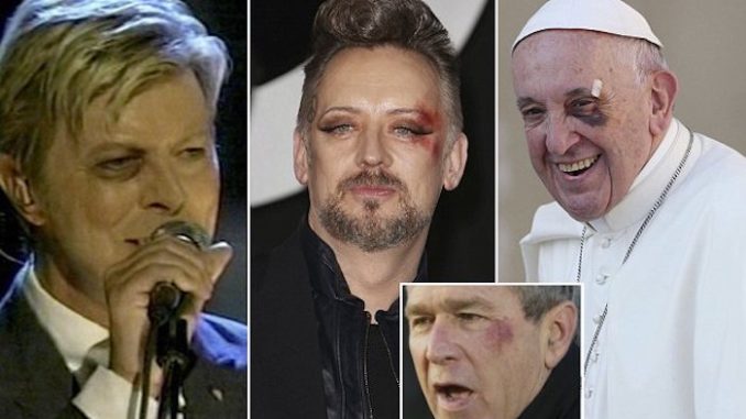 Celebrities With Black Left Eyes Are Part Of The Illuminati, Experts Claim