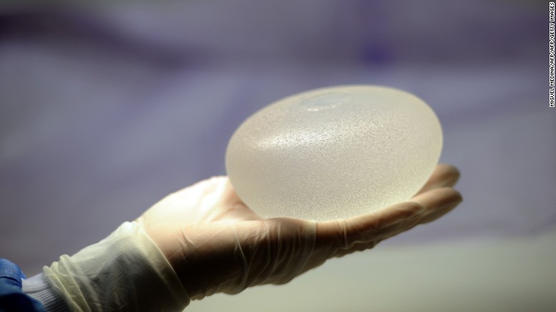 Worldwide recall issued for textured breast implants tied to rare cancer