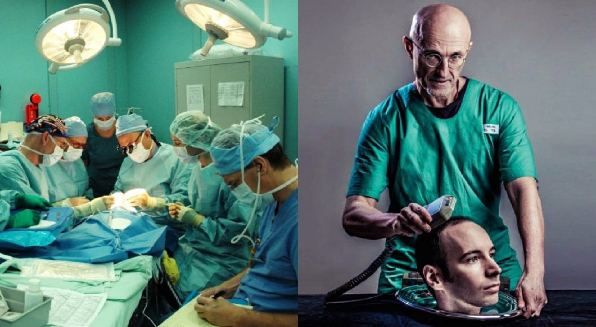 Μεταμόσχευση κεφαλιού: Μέχρι το 2030 θα γίνει η πρώτη επέμβαση, λέει διάσημος νευροχειρουργός