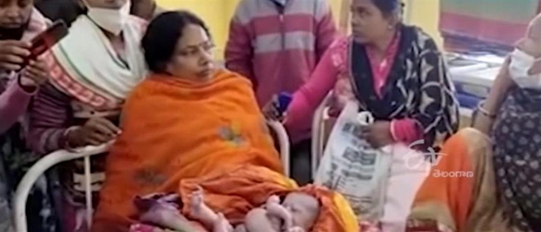 Νέα τερατογένεση στην Ινδία! Μωρό γεννήθηκε με τέσσερα χέρια και τέσσερα πόδια! – ΒΙΝΤΕΟ